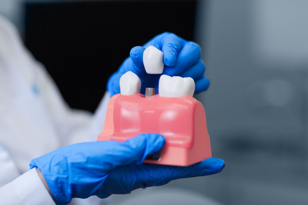 Dental Restorations Lehi
