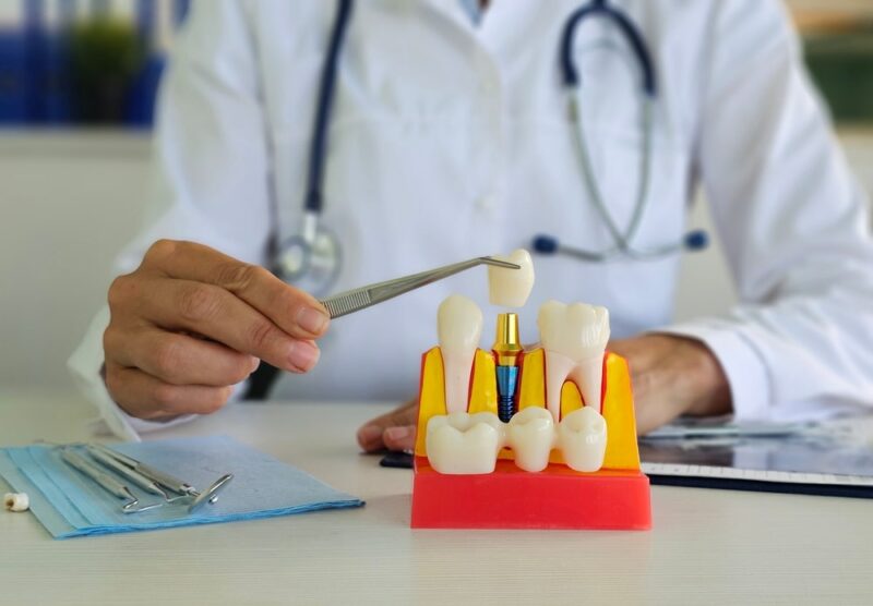 Dental Implants Lehi